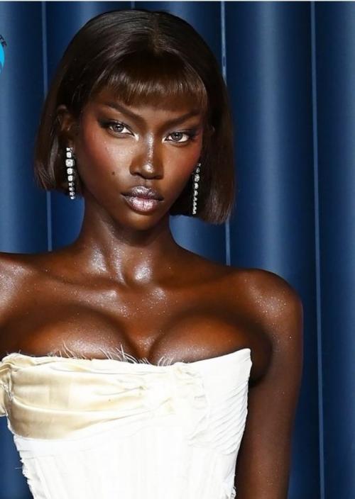 Пока мир видел подиумы, обложки и громкие титулы, Анок яй проживала совсем другую реальность - тихую и изнуряющую борьбу за жизнь. 

