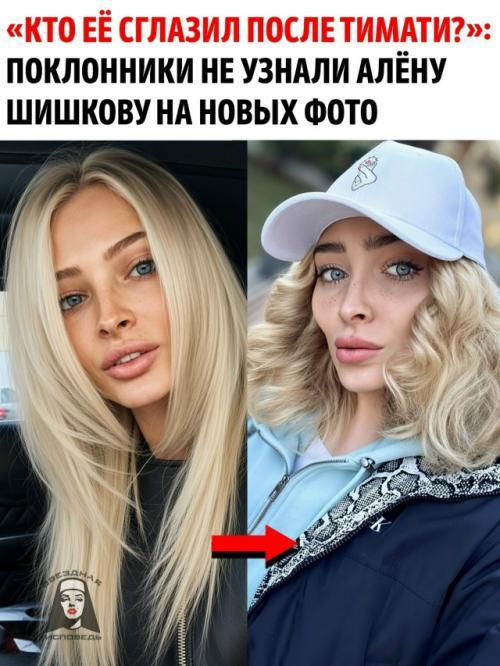 Ещё несколько лет назад Алёну Шишкову называли одной из самых красивых девушек российского шоу-бизнеса.  