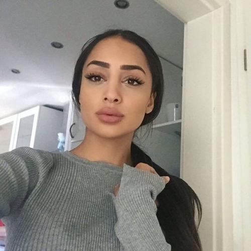 Красные глаза - что делать? 

