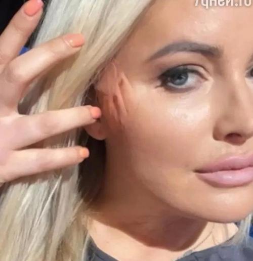 Дану Борисову заподозрили в неудачной пластике: Делал Гастарбайтер. 01