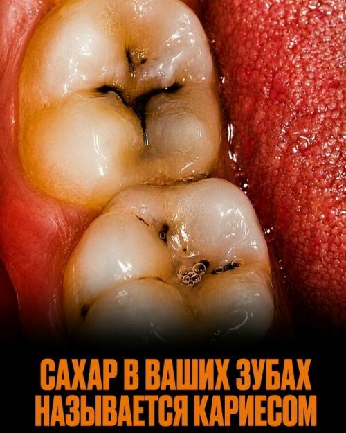 Мы привыкли считать сахар обычной и безобидной частью ежедневного рациона. 03 Мы привыкли считать сахар обычной и безобидной частью ежедневного рациона. 03