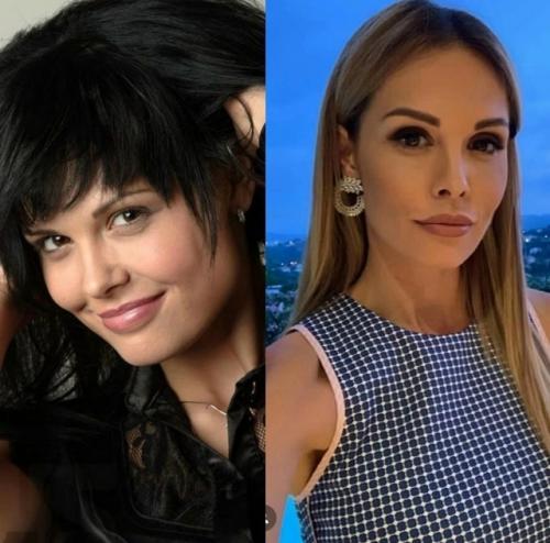 5 звезд, которые после пластики стали просто супер, операции им к лицу. 01 5 звезд, которые после пластики стали просто супер, операции им к лицу. 01