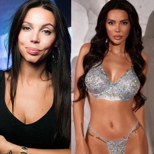 5 звезд, которые после пластики стали просто супер, операции им к лицу. 03 5 звезд, которые после пластики стали просто супер, операции им к лицу. 03