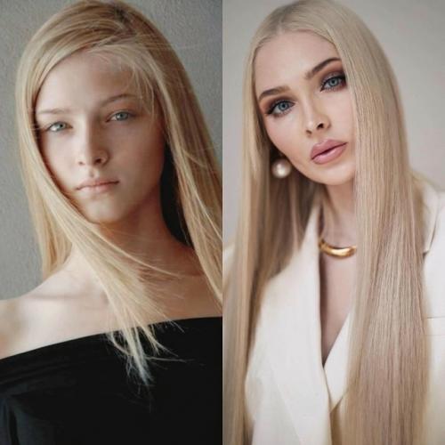 5 звезд, которые после пластики стали просто супер, операции им к лицу. 04 5 звезд, которые после пластики стали просто супер, операции им к лицу. 04