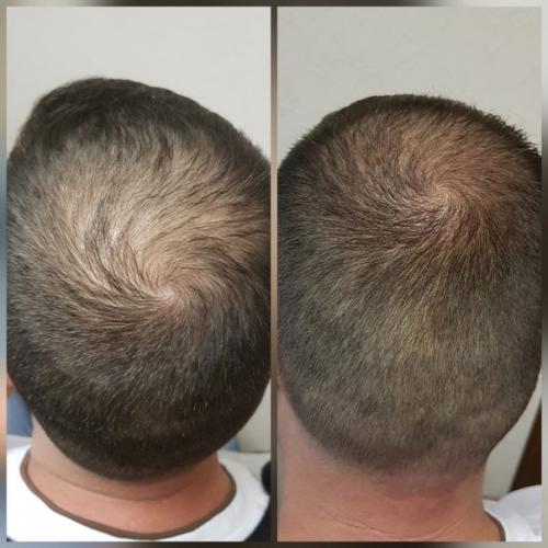 Бесплатно. Ищу моделей мужчин и женщин на трихопигментацию кожи головы к действующему мастеру перманентного макияжа. 01