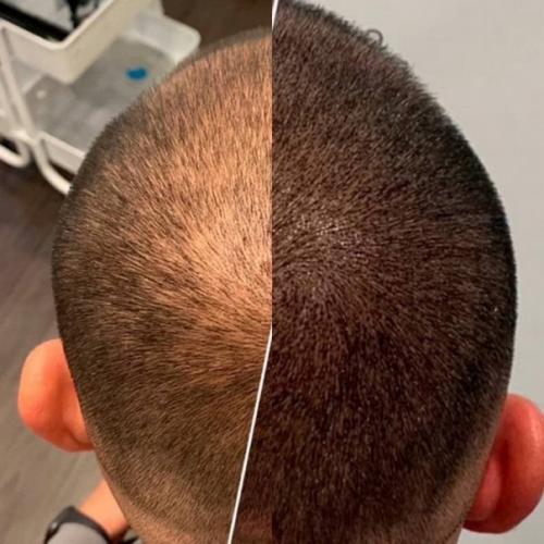 Бесплатно. Ищу моделей мужчин и женщин на трихопигментацию кожи головы к действующему мастеру перманентного макияжа. 02