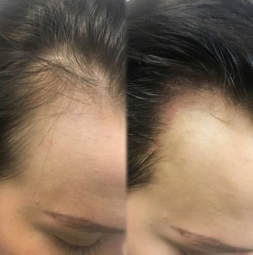 Бесплатно. Ищу моделей мужчин и женщин на трихопигментацию кожи головы к действующему мастеру перманентного макияжа. 05