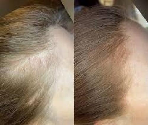 Бесплатно. Ищу моделей мужчин и женщин на трихопигментацию кожи головы к действующему мастеру перманентного макияжа. 06