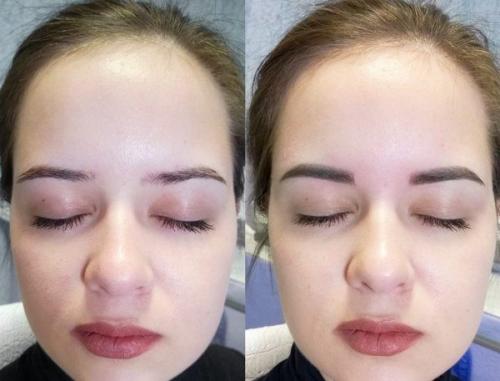 Рефреш бровей, что это. Рефреш бровей — все о данной процедуре 05