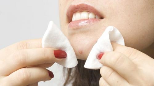 О чем говорят прыщи. Локализация высыпаний 12 О чем говорят прыщи. Локализация высыпаний 12