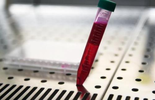 В ВОЗ назвали сроки разработки вакцины против коронавируса. Вирусолог назвал сроки появления вакцины против коронавируса 06 В ВОЗ назвали сроки разработки вакцины против коронавируса. Вирусолог назвал сроки появления вакцины против коронавируса 06