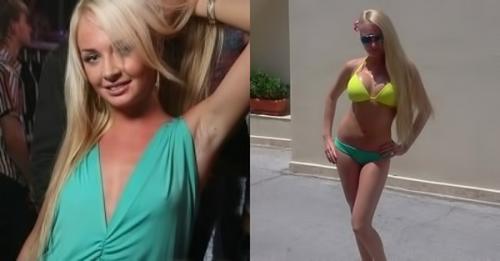 Дом-2 до и после пластики. Пластические операции на ДОМ-2. До и после (15 фото)