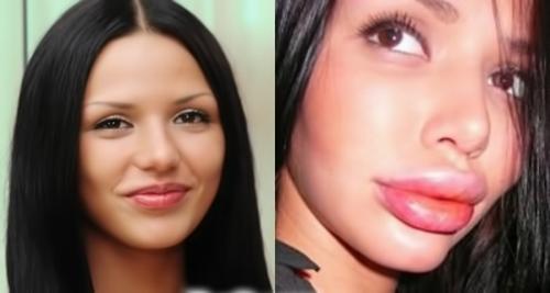 Дом-2 до и после пластики. Пластические операции на ДОМ-2. До и после (15 фото)