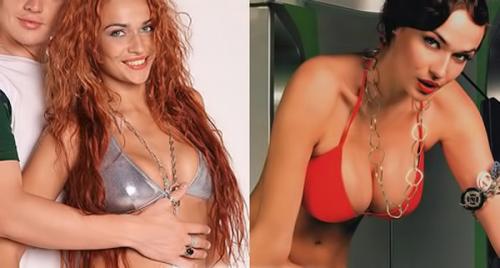 Дом-2 до и после пластики. Пластические операции на ДОМ-2. До и после (15 фото)