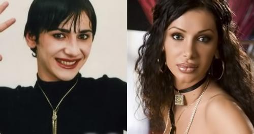 Дом-2 до и после пластики. Пластические операции на ДОМ-2. До и после (15 фото)