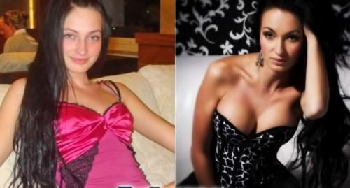 Дом-2 до и после пластики. Пластические операции на ДОМ-2. До и после (15 фото)