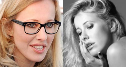 Дом-2 до и после пластики. Пластические операции на ДОМ-2. До и после (15 фото)