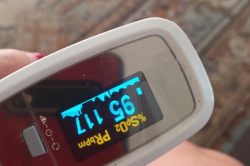 Симптомы и профилактика коронавируса у человека 2020. Заболевшая врач описала новый симптом коронавируса: Синеют ноги