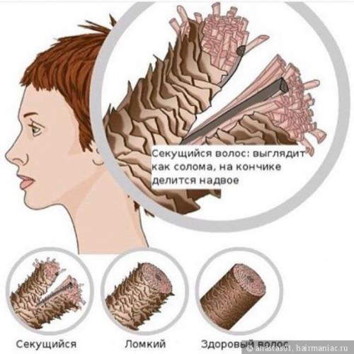 Волосы торчат по всей длине. Сечение волос по всей длине. Как я справляюсь