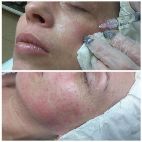 Как подтянуть овал лица после 45 лет. Как подтянуть овал лица