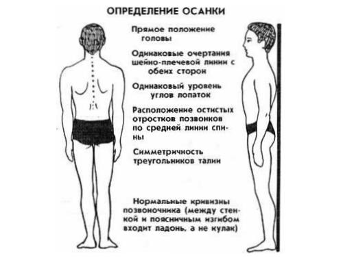 Упражнения для ровной осанки дома. Плюсы правильной осанки и способ ее проверки