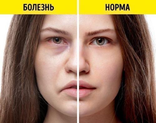 Болезни по лицу. Диагностирование болезней по лицу человека 08