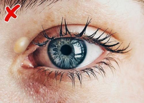 Болезни по лицу. Диагностирование болезней по лицу человека 05