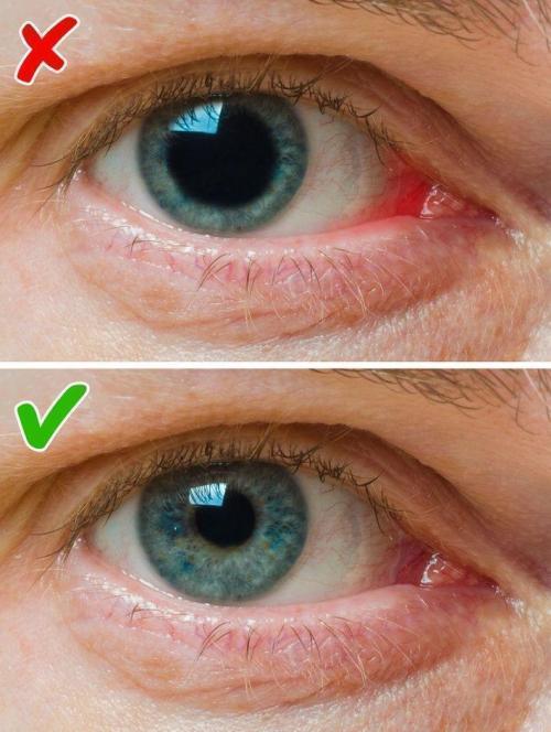 Болезни по лицу. Диагностирование болезней по лицу человека 02