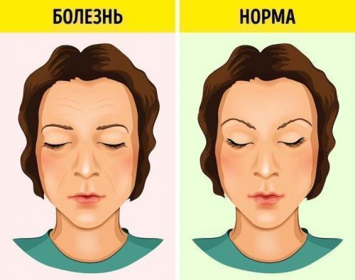 Болезни по лицу. Диагностирование болезней по лицу человека 04