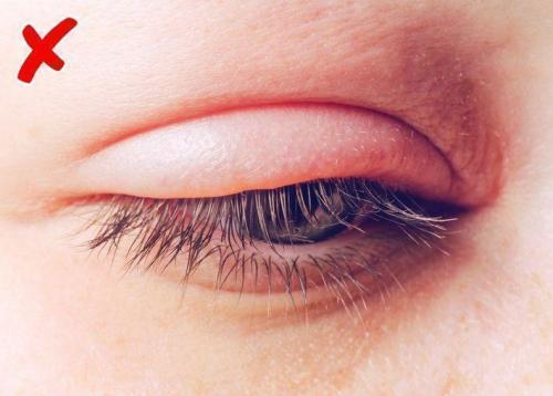 Болезни по лицу. Диагностирование болезней по лицу человека 06