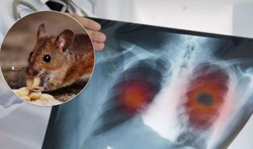 Новый вирус в Китае 2020 хантавирус. Хантавирус в Китае в 2020 году и что это такое