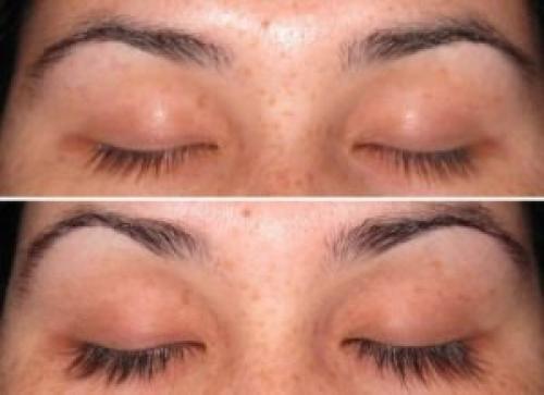 Касторовое масло или репейное для бровей. Какое масло для бровей самое лучшее для их роста и густоты? 10 Касторовое масло или репейное для бровей. Какое масло для бровей самое лучшее для их роста и густоты? 10