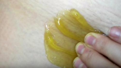 Как удалить волосы в интимной зоне навсегда. Ваксинг, депиляция шугаринг глубокое бикини