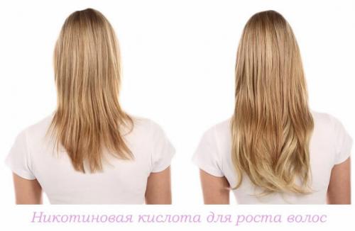 Как отрастить длинные волосы. Хитрость №1: Изучаем подшерсток
