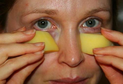 Как избавиться от темных кругов под глазами. Темные круги под глазами —, как избавиться в домашних условиях