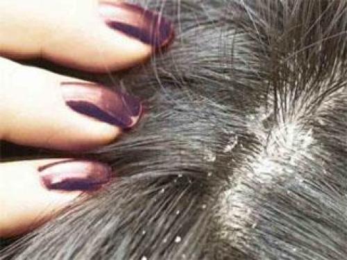 Маска для волос оливковое масло. Маска для волос с оливковым маслом 06 Маска для волос оливковое масло. Маска для волос с оливковым маслом 06