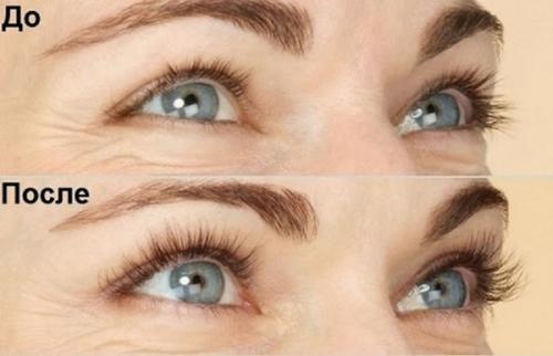 Что лучше для ресниц репейное масло или касторовое. Касторовое или репейное масло: какое лучше для укрепления ресниц и бровей 03 Что лучше для ресниц репейное масло или касторовое. Касторовое или репейное масло: какое лучше для укрепления ресниц и бровей 03