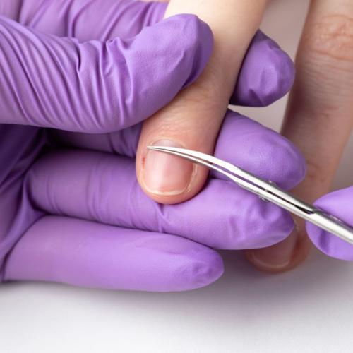 Почему облазит гель-лак на кончиках ногтей. Почему гель-лак не держится на ногтях?