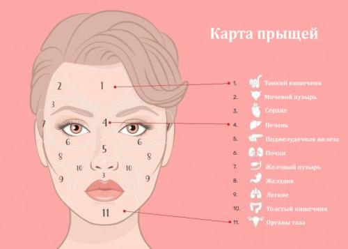 Прыщики на лице по зонам. Карта прыщей на лице и внутренние причины появления акне