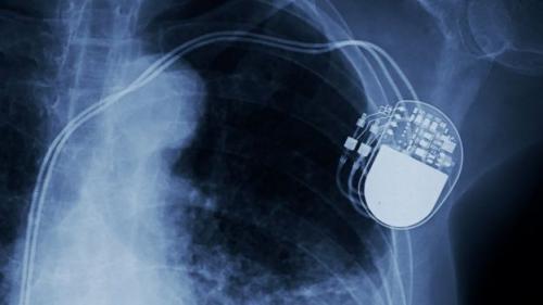 Что нужно изобрести людям, чтобы полеты в космос были безопасными. Вещи, которые изменились благодаря полетам в космос в закладки 1