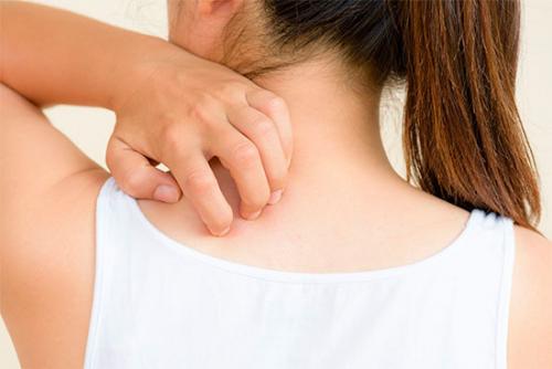 Прыщи на теле о чем говорят. Прыщи на теле: причины и лечение