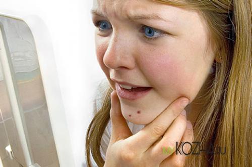 Выдавила прыщ на родинке. Что делать, если на родинке появился прыщ?