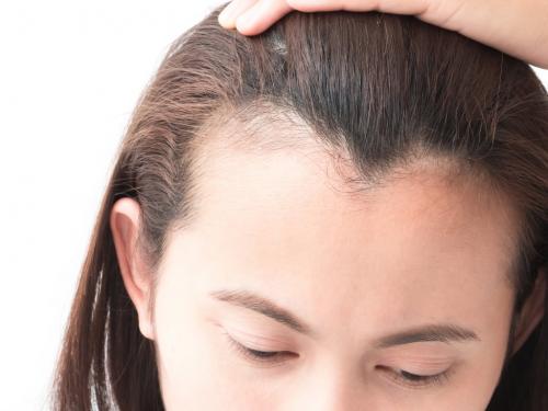 Что делать с мелкими волосками на линии лба: советы и решения 02