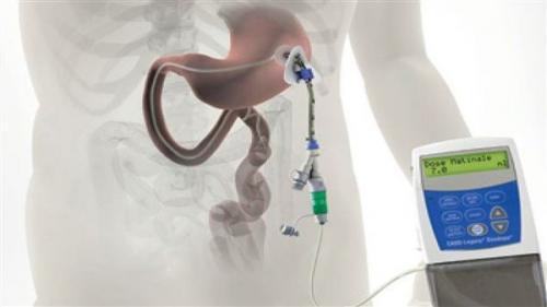 Ходьба в пожилом возрасте. Нормальные возрастные изменения походки 03 Ходьба в пожилом возрасте. Нормальные возрастные изменения походки 03