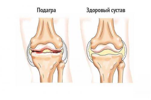9 способов профилактики заболеваний мочевыделительной системы. Мочевыделительная система: что делать, чтобы не болеть? 05 9 способов профилактики заболеваний мочевыделительной системы. Мочевыделительная система: что делать, чтобы не болеть? 05