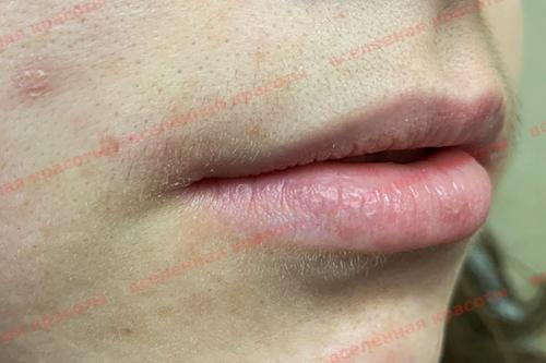 Как убрать торчащие короткие волоски: эффективные методы для гладкой кожи 09 Как убрать торчащие короткие волоски: эффективные методы для гладкой кожи 09