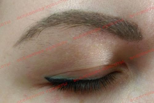 Как убрать торчащие короткие волоски: эффективные методы для гладкой кожи 07 Как убрать торчащие короткие волоски: эффективные методы для гладкой кожи 07