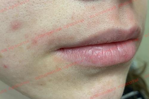 Как убрать торчащие короткие волоски: эффективные методы для гладкой кожи 10 Как убрать торчащие короткие волоски: эффективные методы для гладкой кожи 10