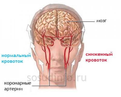10 главных упражнений для тех. Упражнения на все группы мышц: комплекс для занятий в домашних условиях 02 10 главных упражнений для тех. Упражнения на все группы мышц: комплекс для занятий в домашних условиях 02