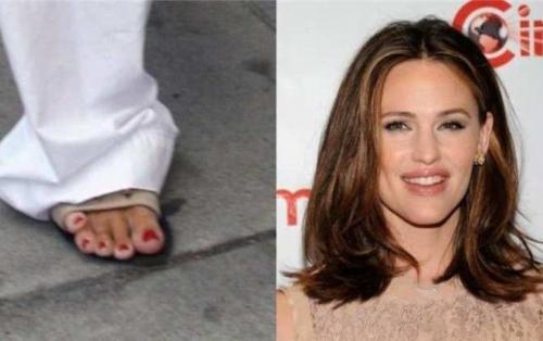 Самые некрасивые руки знаменитостей. 10 знаменитостей с проблемными и некрасивыми руками 10